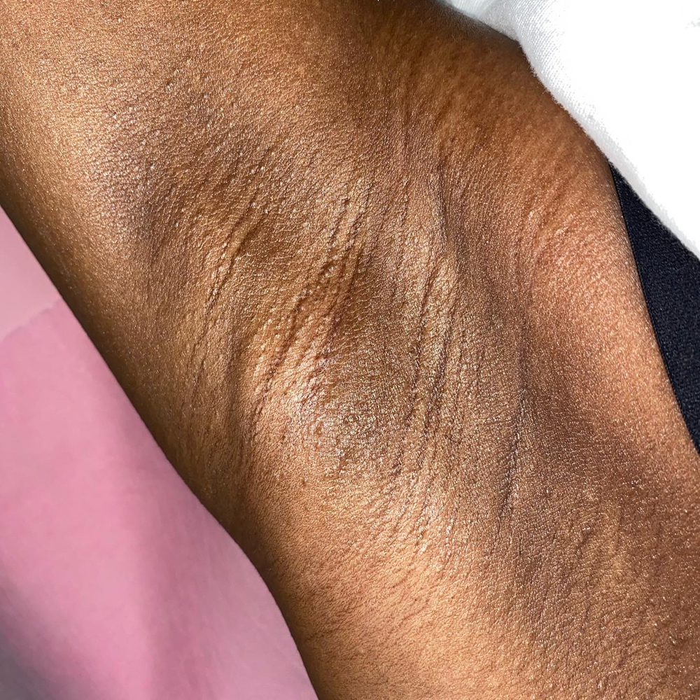 Underarms at Boujee with Beauty in Wichita, KS