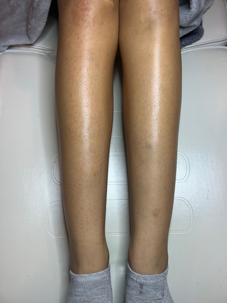 Full Leg Wax