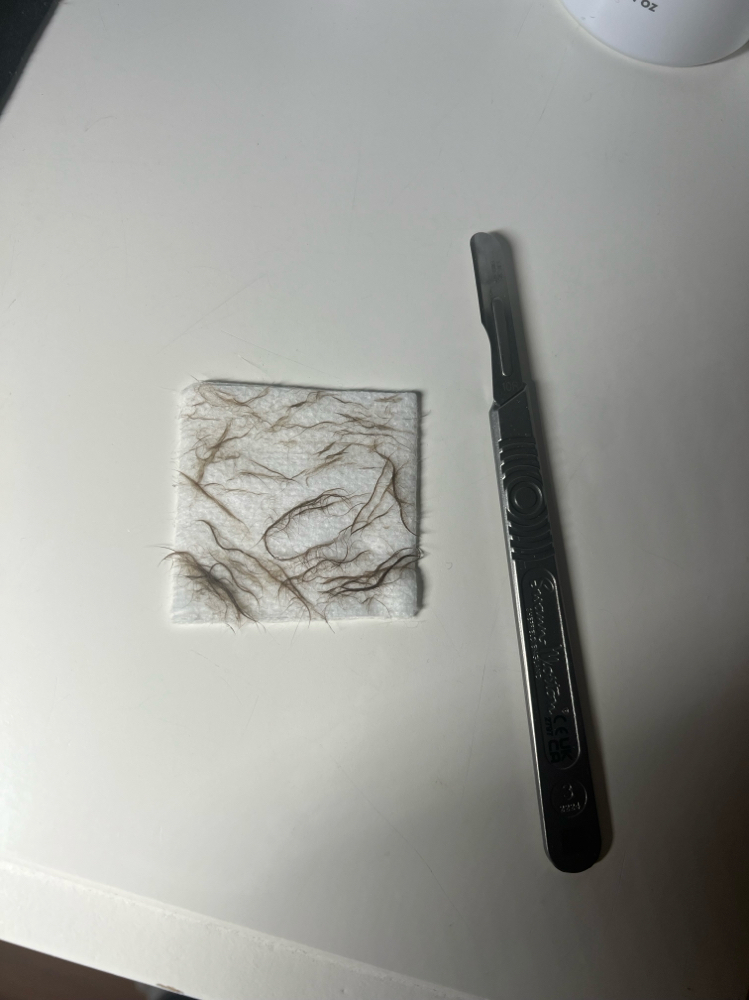 Add On Dermaplaning