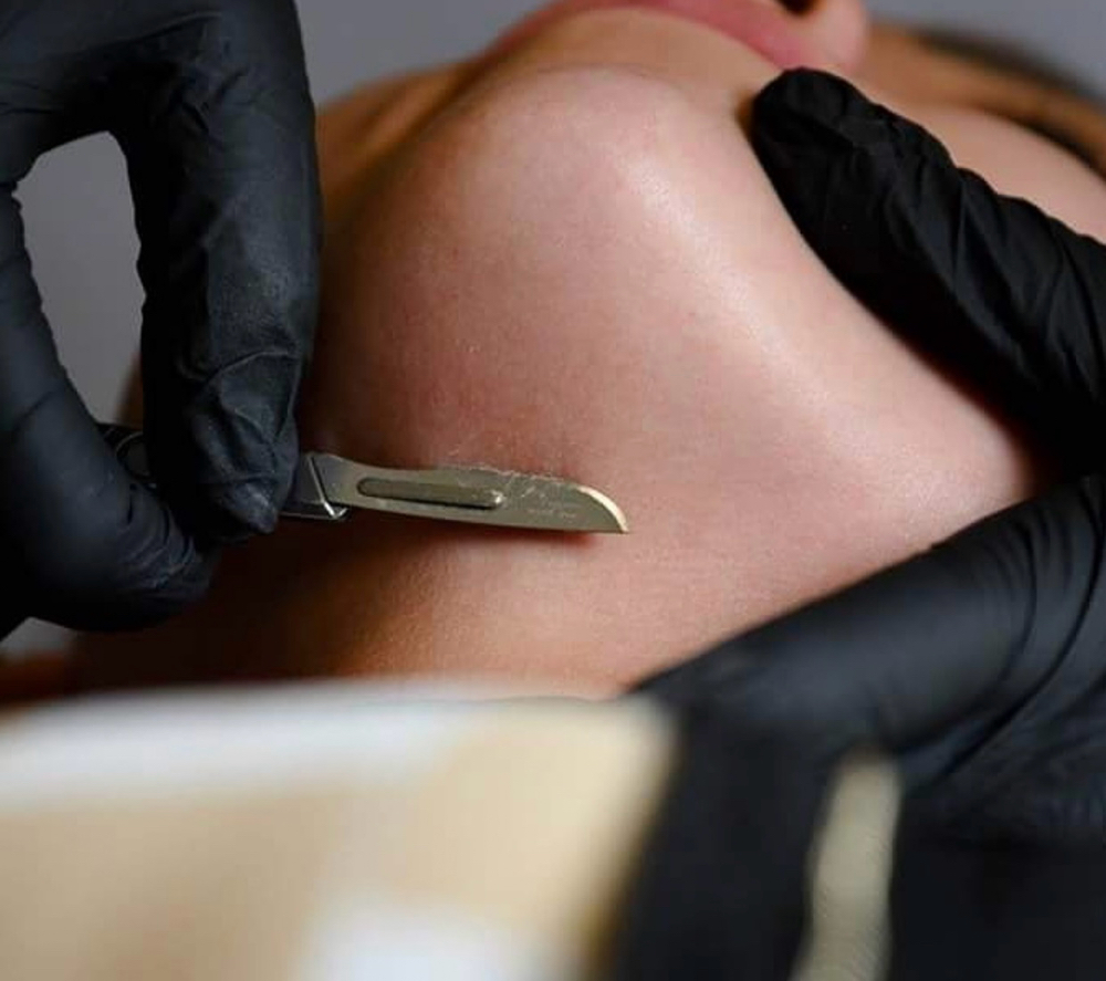 DERMAPLANE ADD-ON