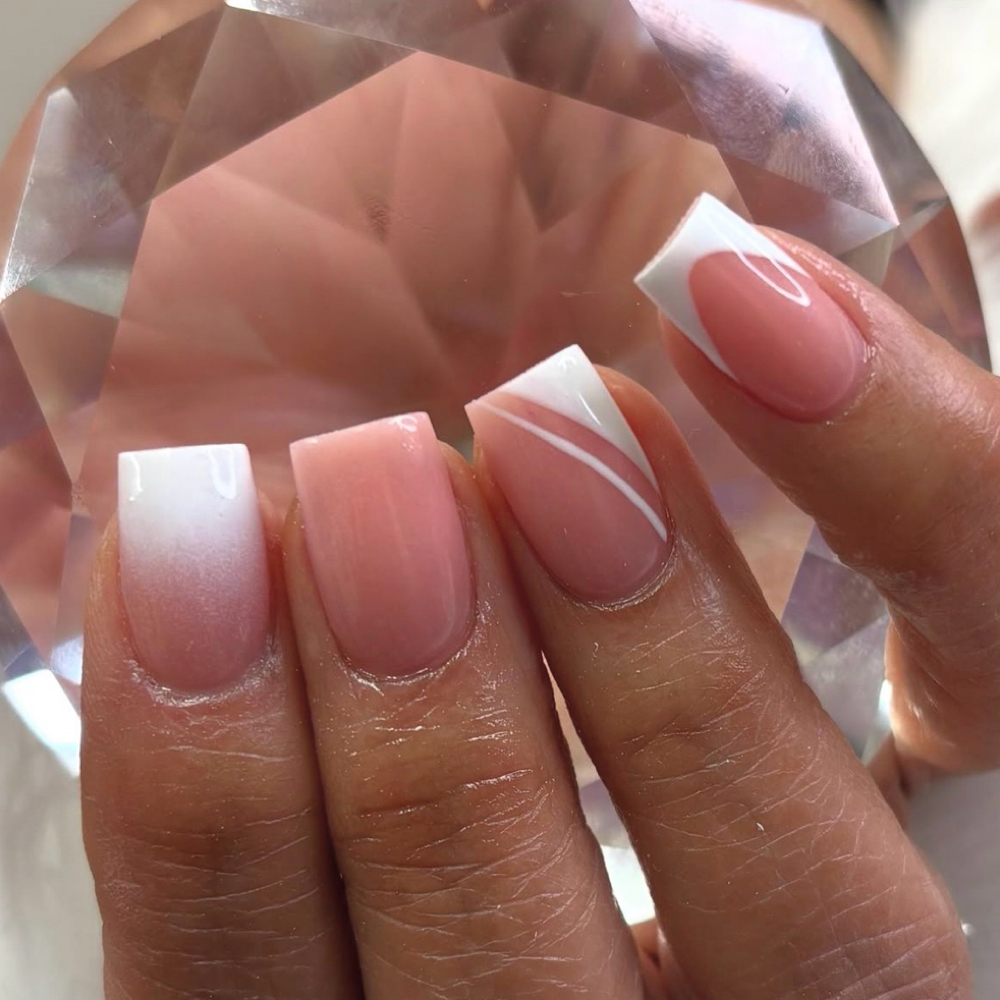 Overlay at Esthetics Equals Passion in Tempe, AZ