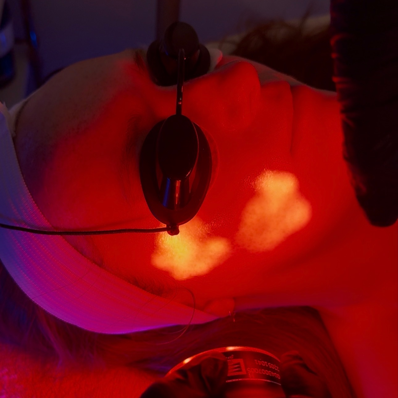 Hydrafacial Platinum at Illuminate Aesthetics in Greensboro, NC