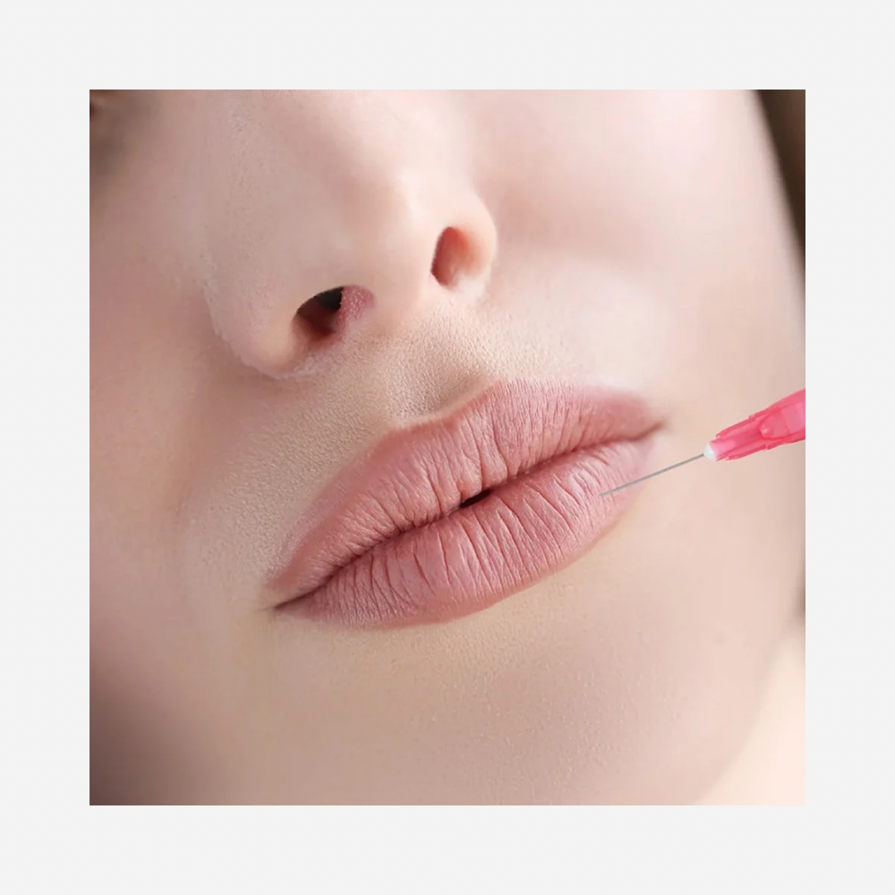 Mini Lip Filler
