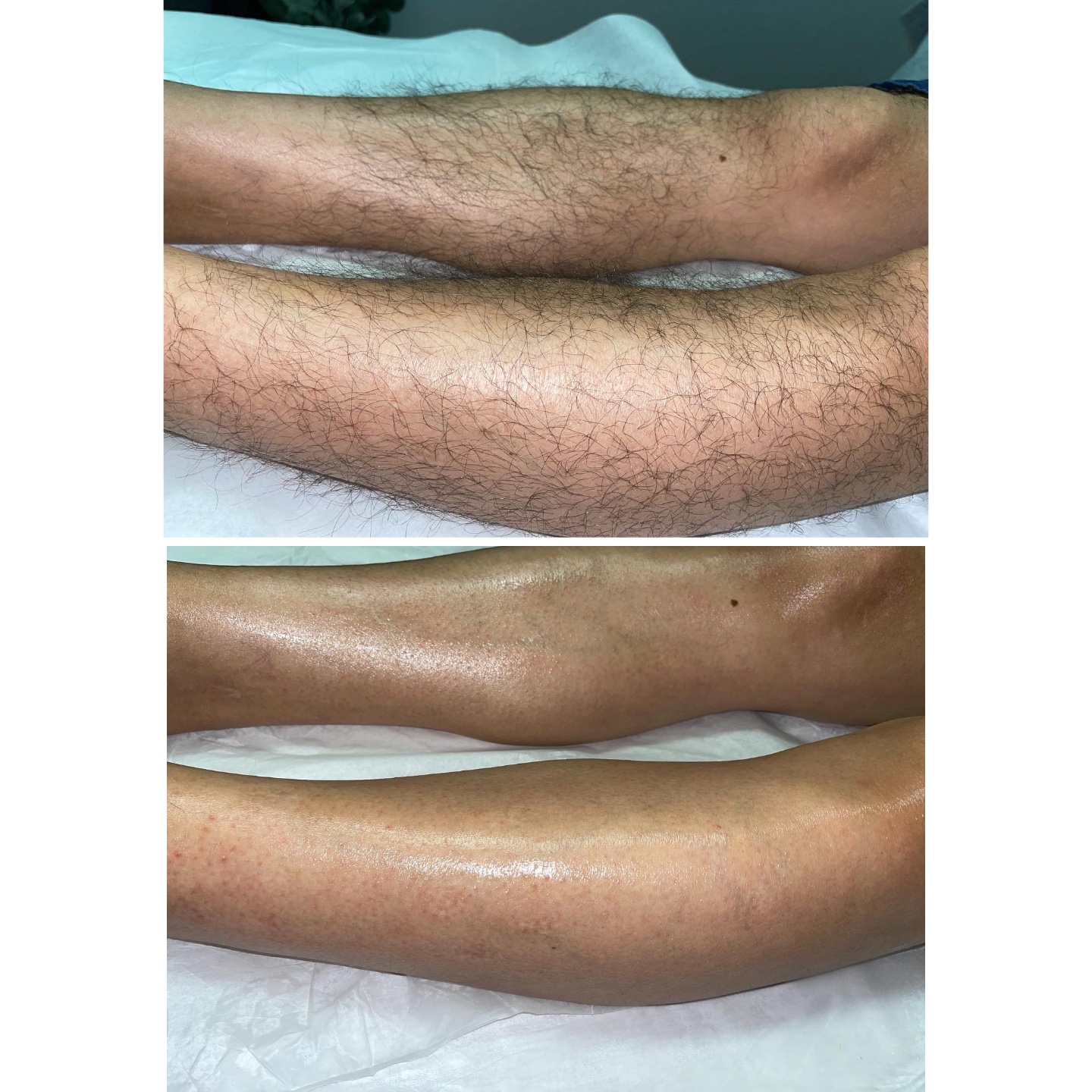 Lower legs