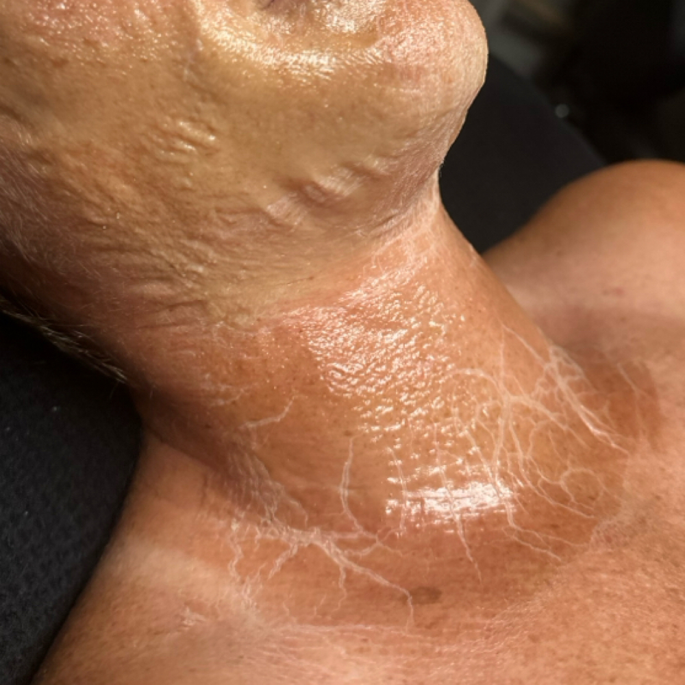Firming Peptide Facial *MODEL* at LANI Salon and Spa in Vero Beach, FL