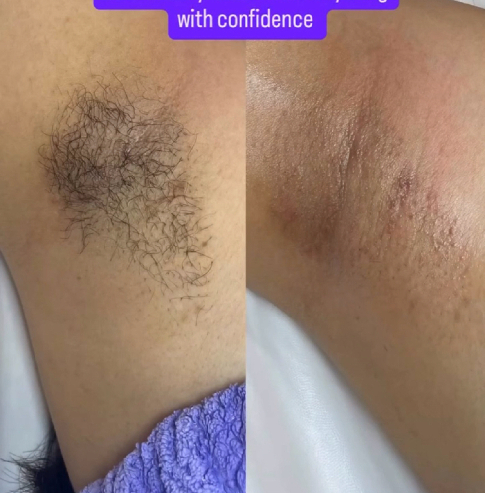 Underarm wax at Les Talk Beautie in Riverside, CA