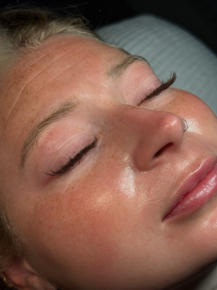 Dermaplane Facial