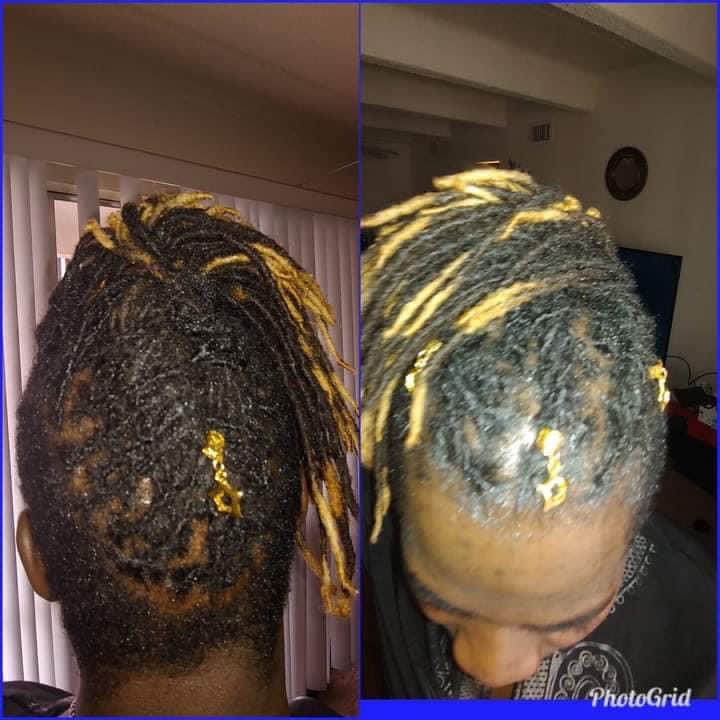 Inter-locs Tightening