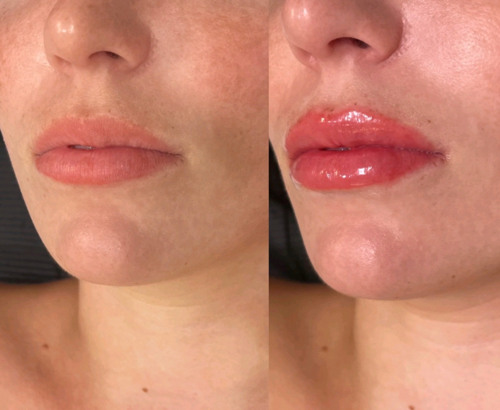 Lip Blushing Yearly Touch Up