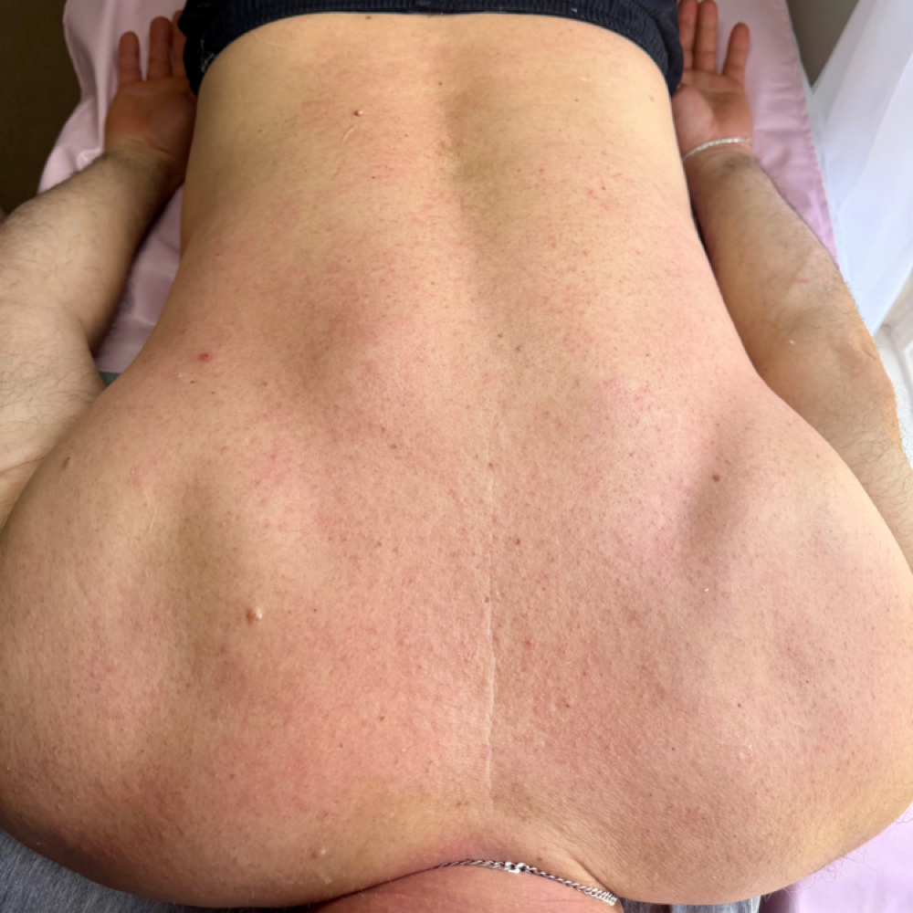 FULL BACK at Soft Stone Esthetics in Bladensburg, MD