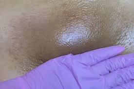 May Brazilian Wax & Underarm Wax