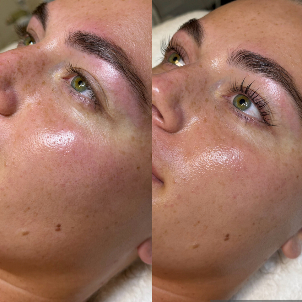 Korean Lash Lift + Tint at The Skin Method in Overland Park, KS