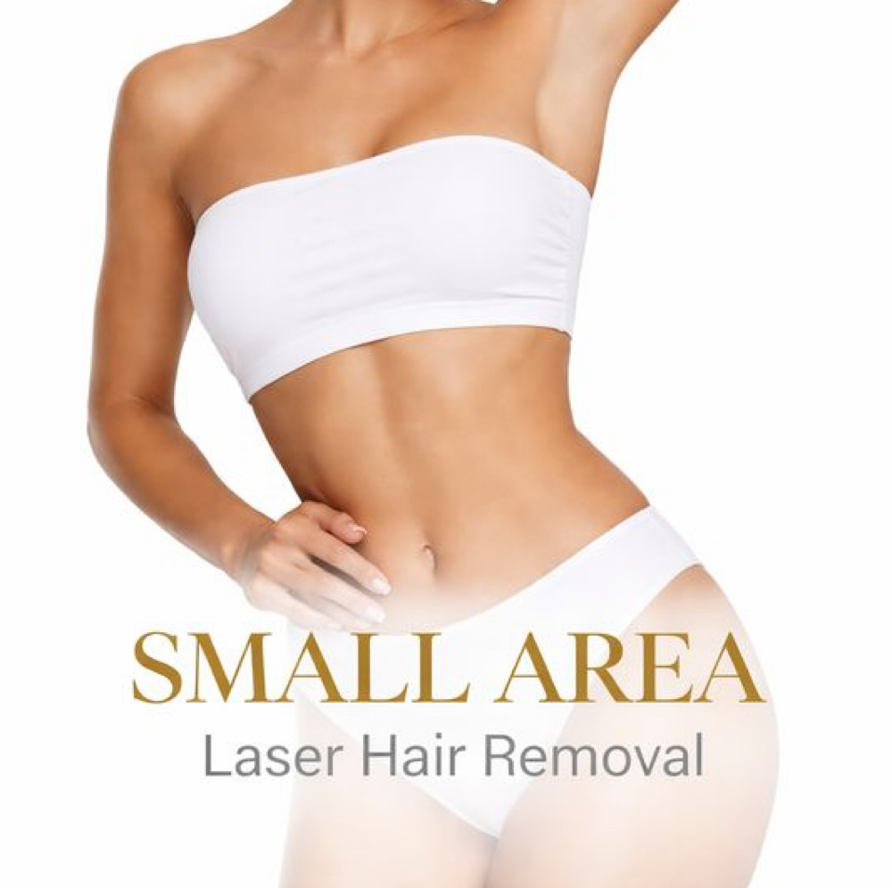 Laser hair Removal - Small Area at Studios Secrets in Dallas, TX