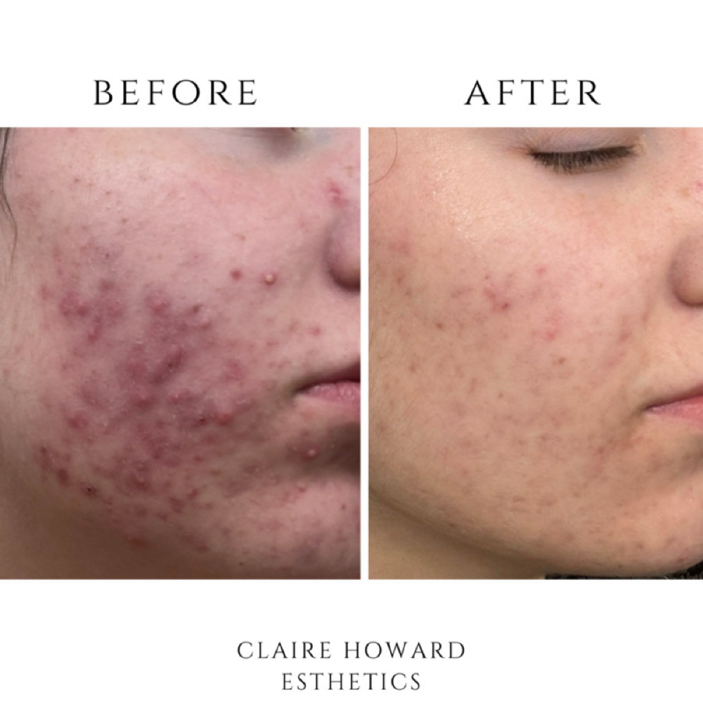 Online Appointment at Claire Howard Esthetics in Wichita Falls, TX