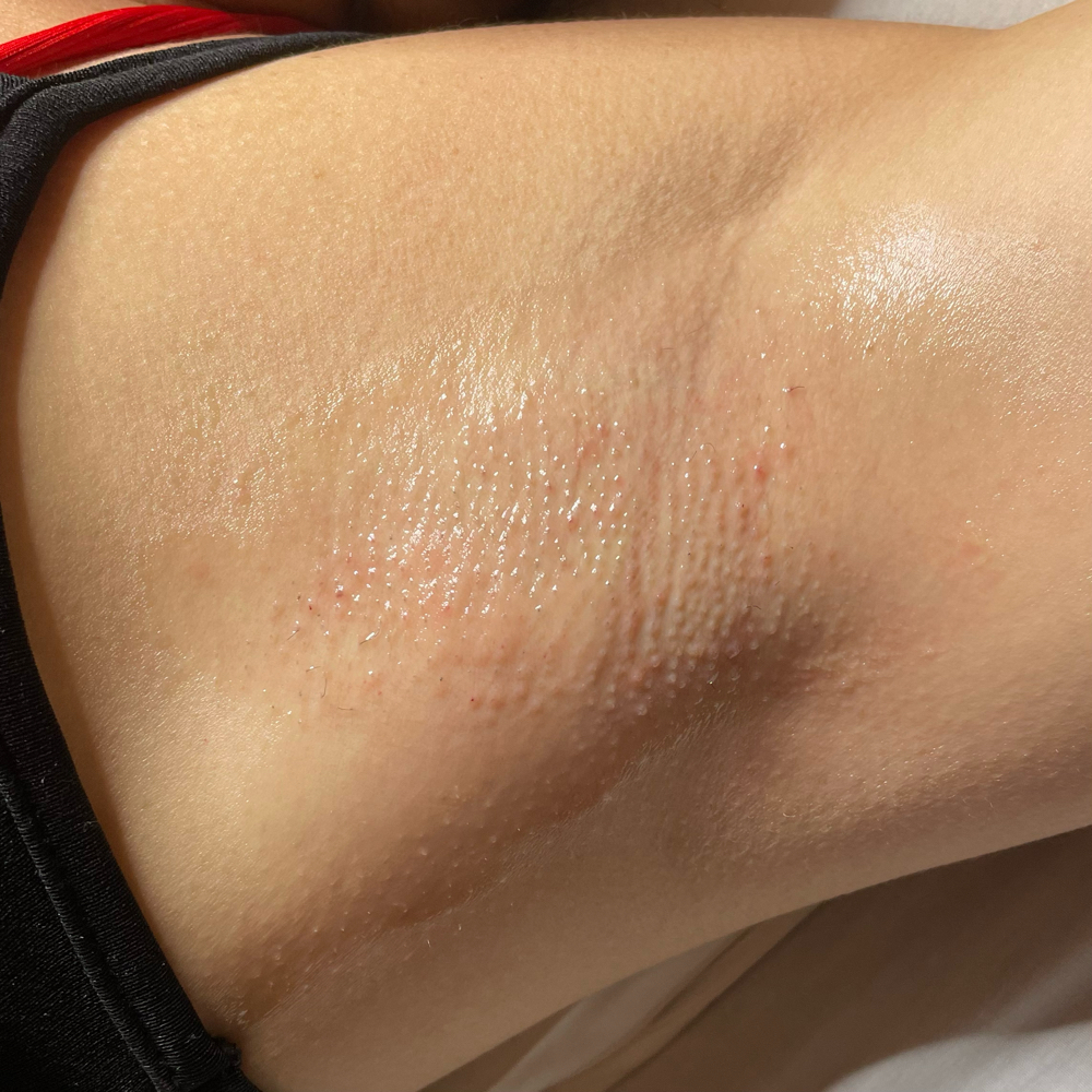Underarm wax