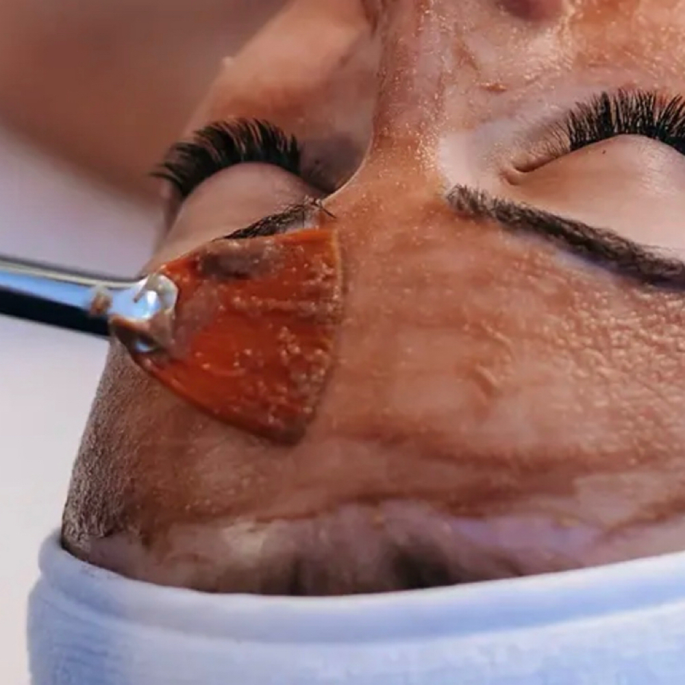 Berries & Bubbly Glow Facial at Carisma Esthetics in Hurst, TX