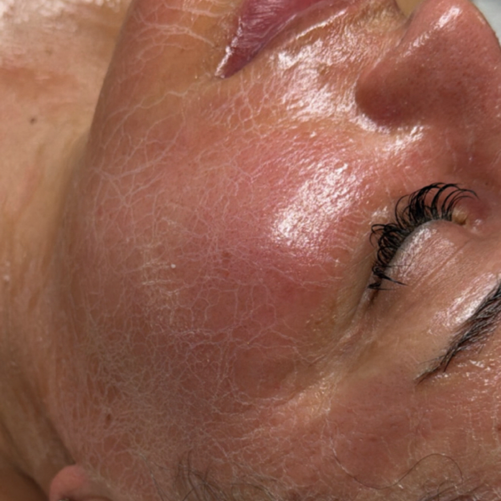 Customized Facial at Blu Topaz Esthetics in Aurora, IL