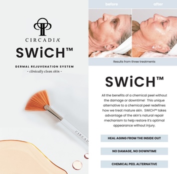 Swich