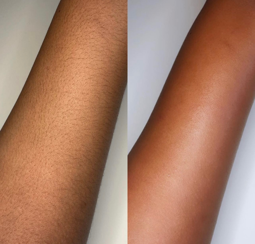 𝒜𝓇𝓂 𝒲𝒶𝓍