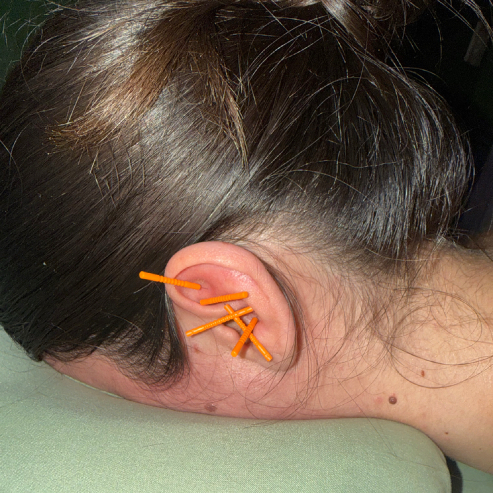 Ear Acupuncture Add On ✨ at Relaxing Rose Therapeutic Massage in Taylor, MI