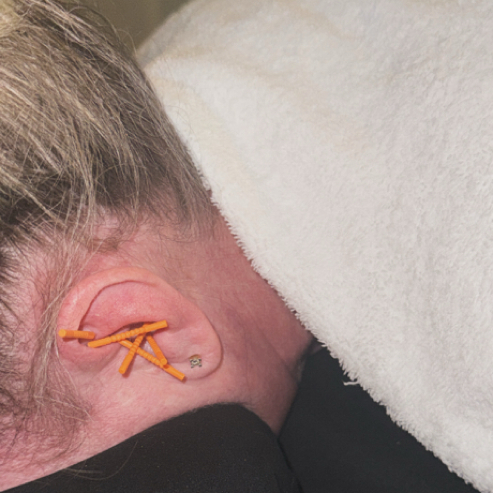 Ear Acupuncture Add On ✨ at Relaxing Rose Therapeutic Massage in Lincoln Park, MI