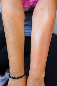 Waxing - Half Arm