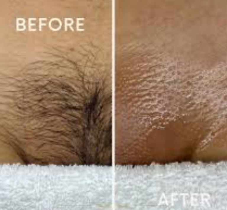 Full Brazilian  Wax