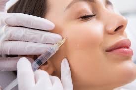 Dermal Fillers-Cheeks