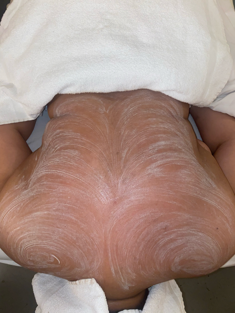 Back Facial