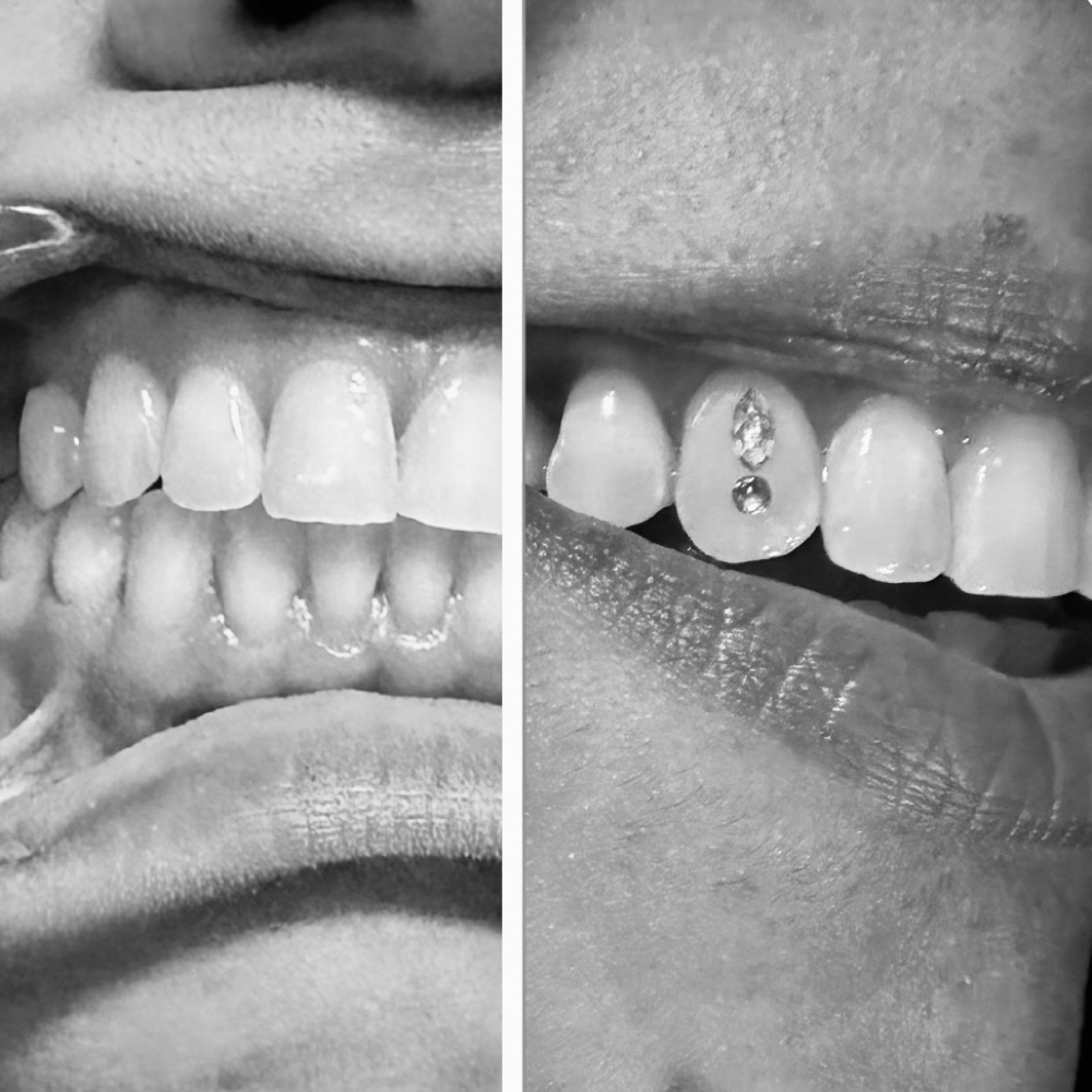 Tooth Gems at RGV beauty studio in Edinburg, TX