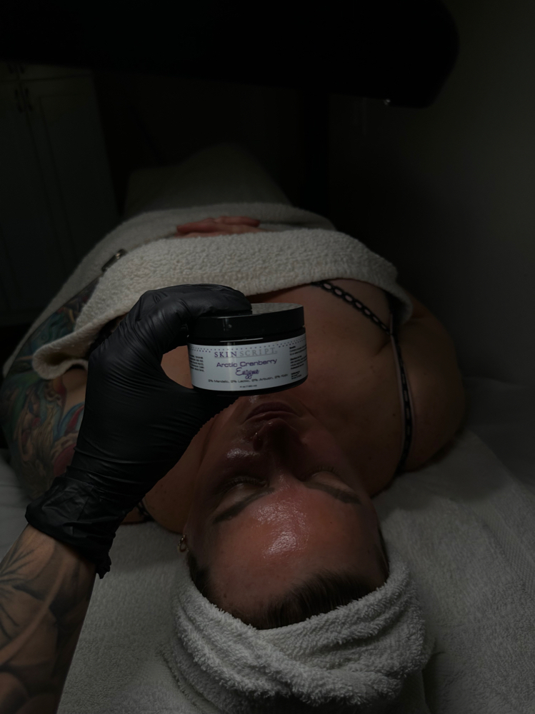 ENZYME PEEL