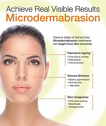 Microdermabrasion (Add On)