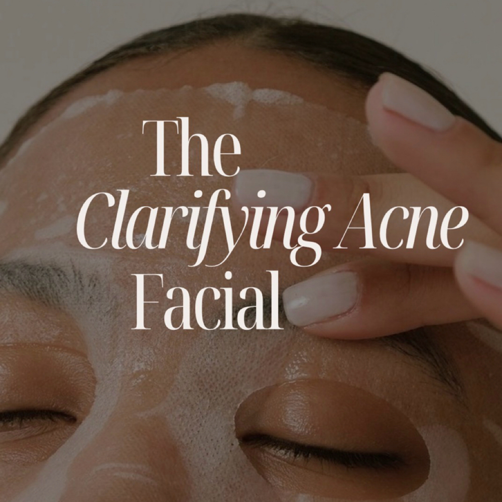 Clarifying Acne Facial at Madsesthetics LLC in Litchfield Park, AZ