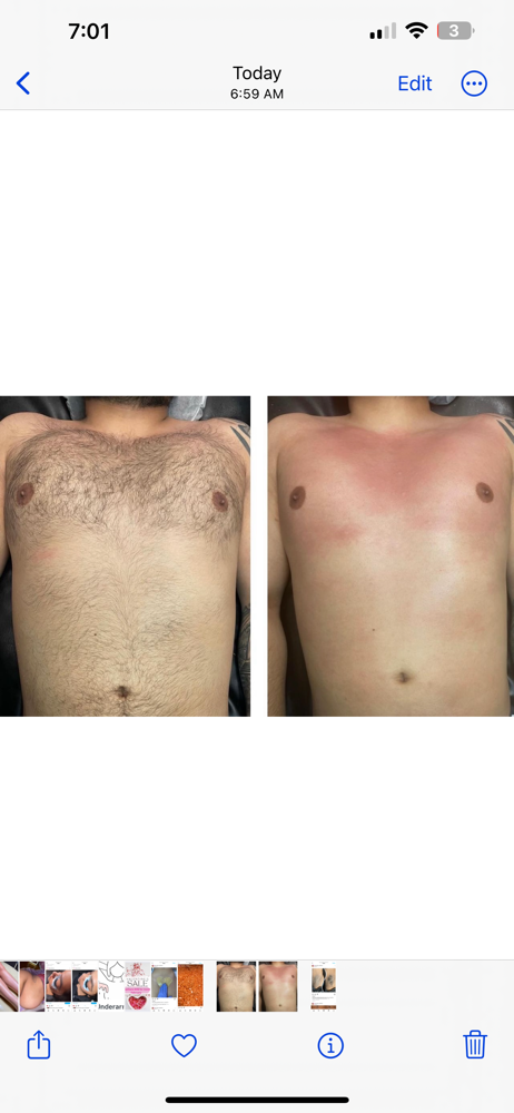 Full Chest+Stomach