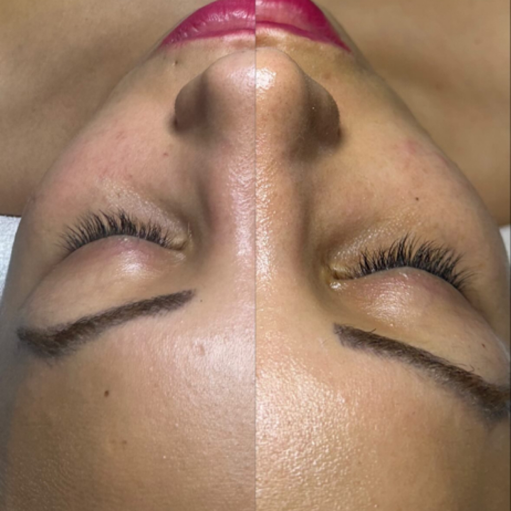 Premiun Facial at SiempreBellasBeautySpa in North Miami, FL
