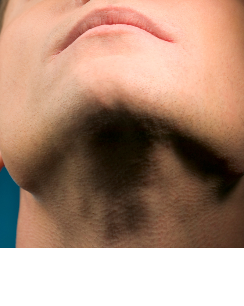 Chin at Erin & Esthetics in Long Beach, CA