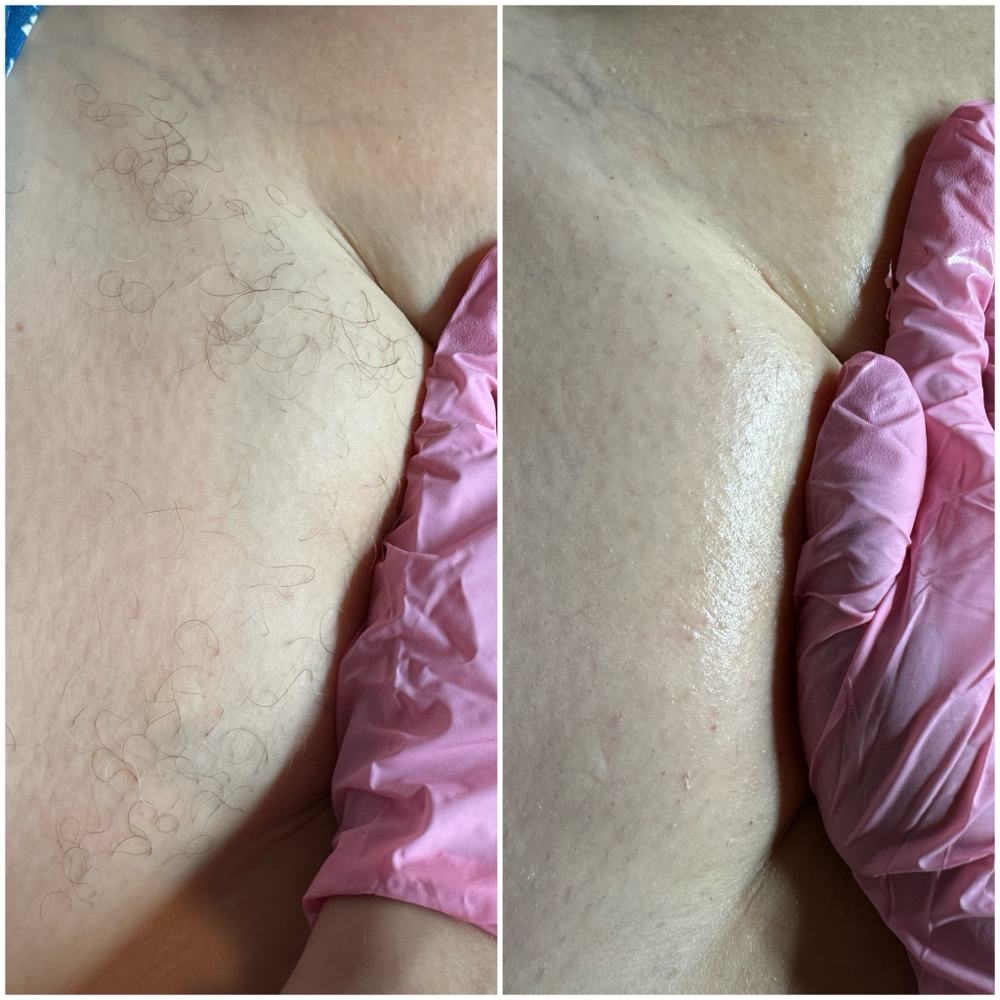 Buy 3 Brazilian Wax Get One Free