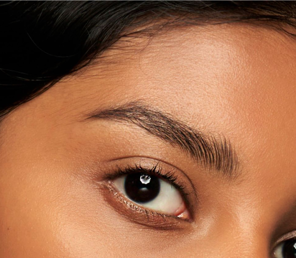 Brow Lift