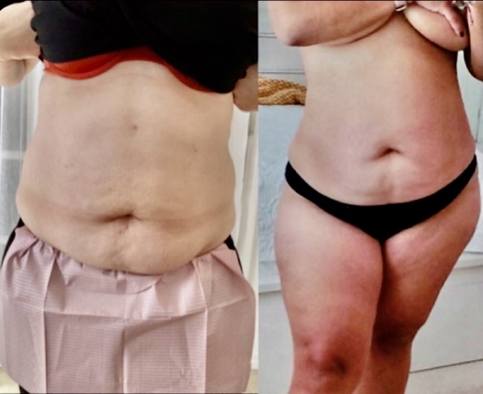 Fat Burners