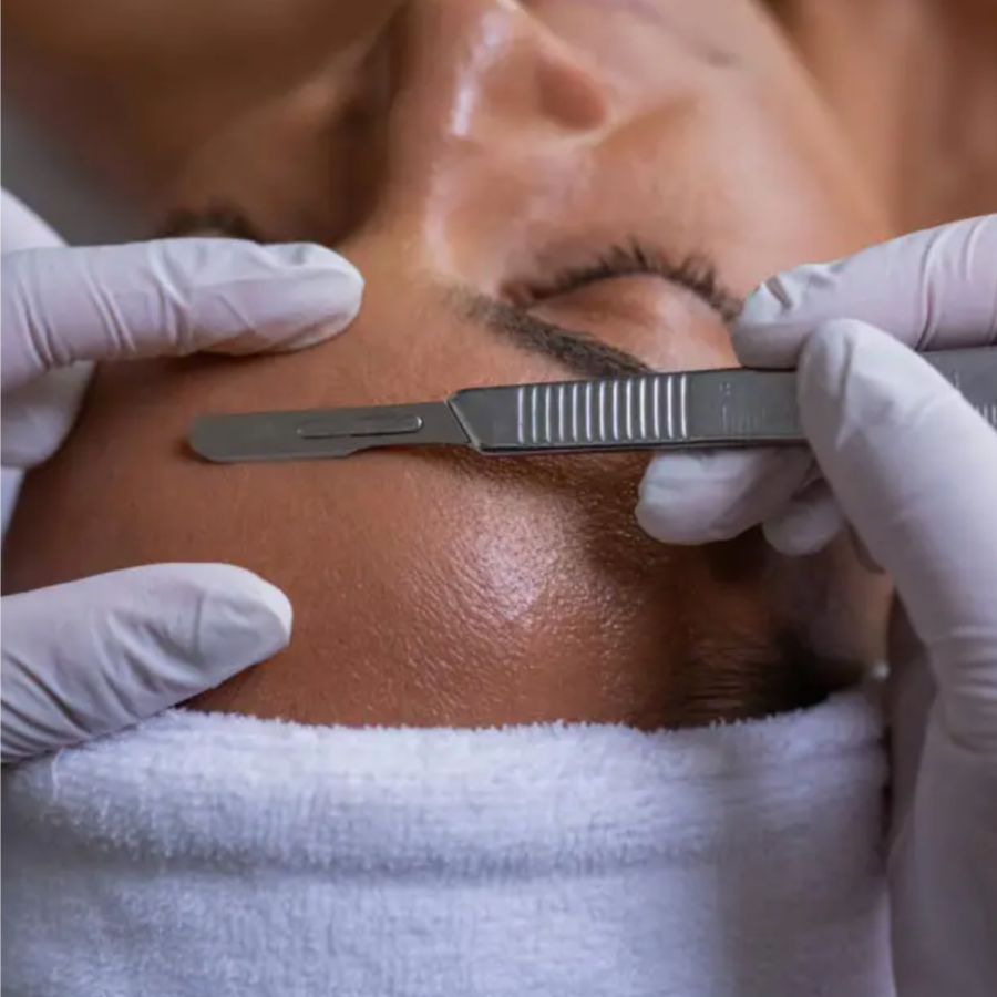 Dermaplaning Add-On at Skin By Esty in Murrieta, CA