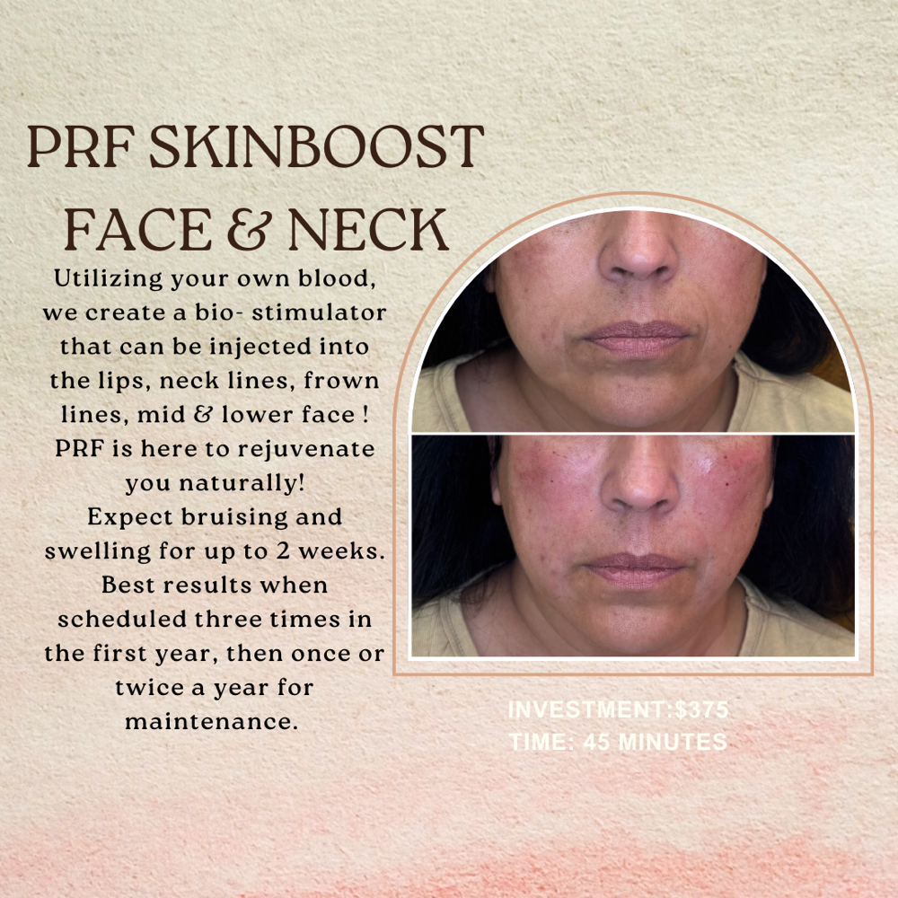 Face & Neck PRF SKINBOOST