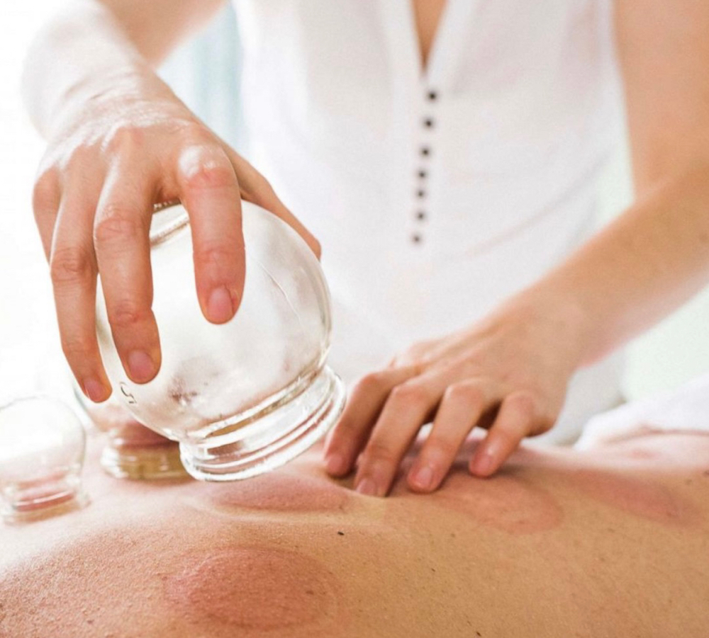 Fire Cupping therapy - ADD ON