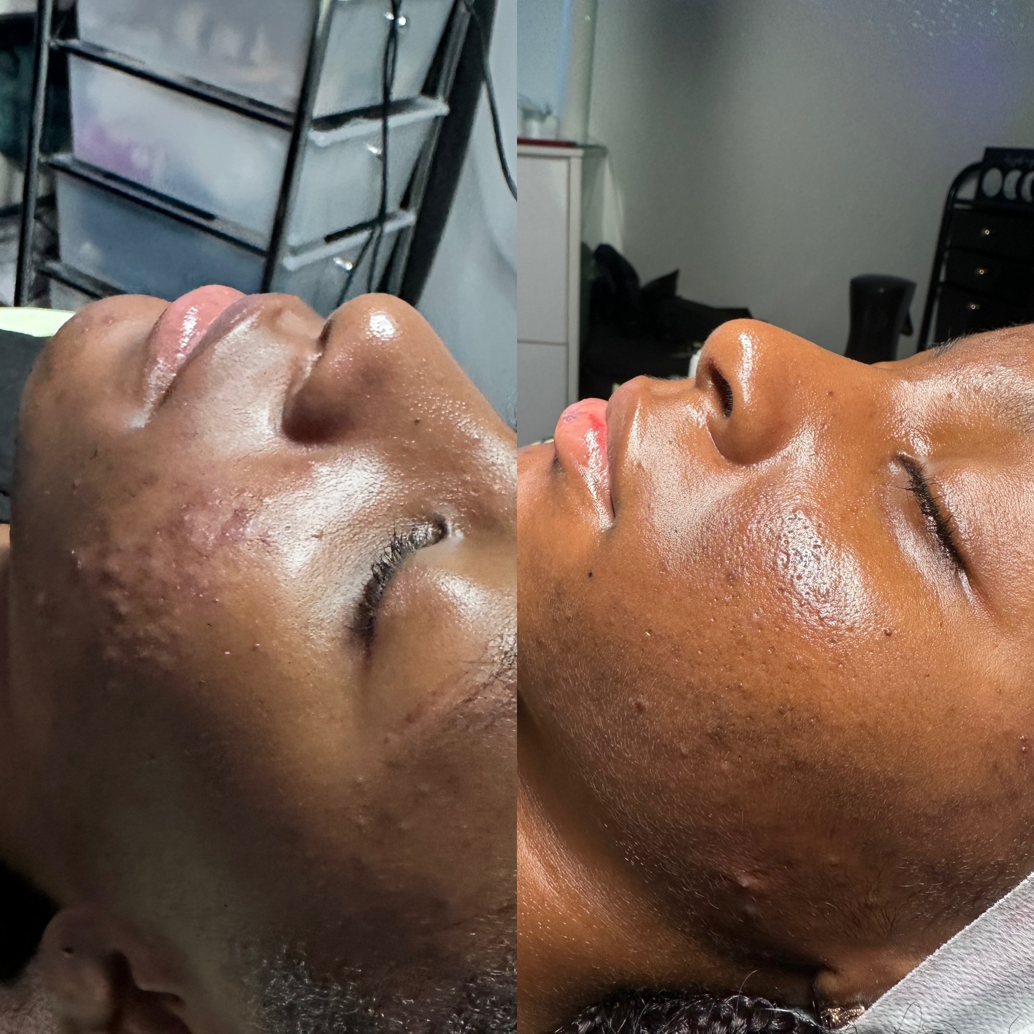 Teen Skin Health Facial (Age 13-17)