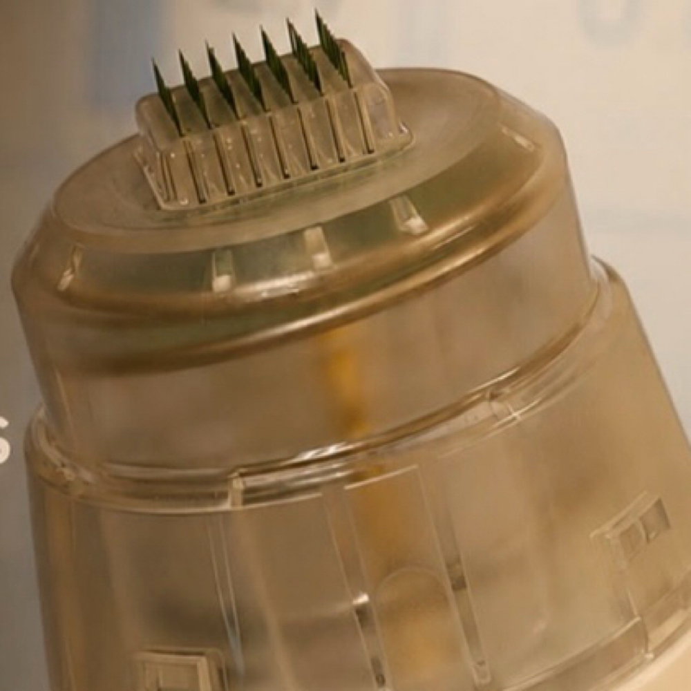 Matrix Rf Micro Needling at London West Aesthetics in Houston, TX