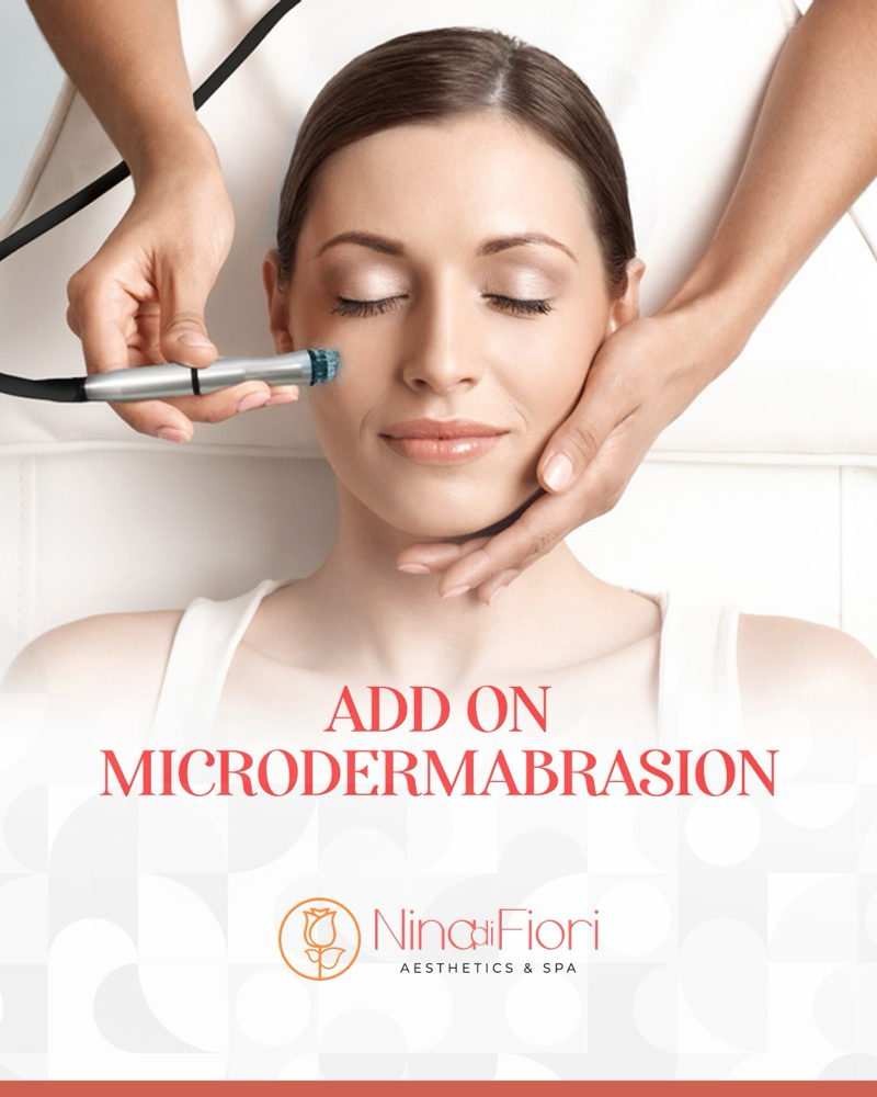 Add On - Microdermabrasion