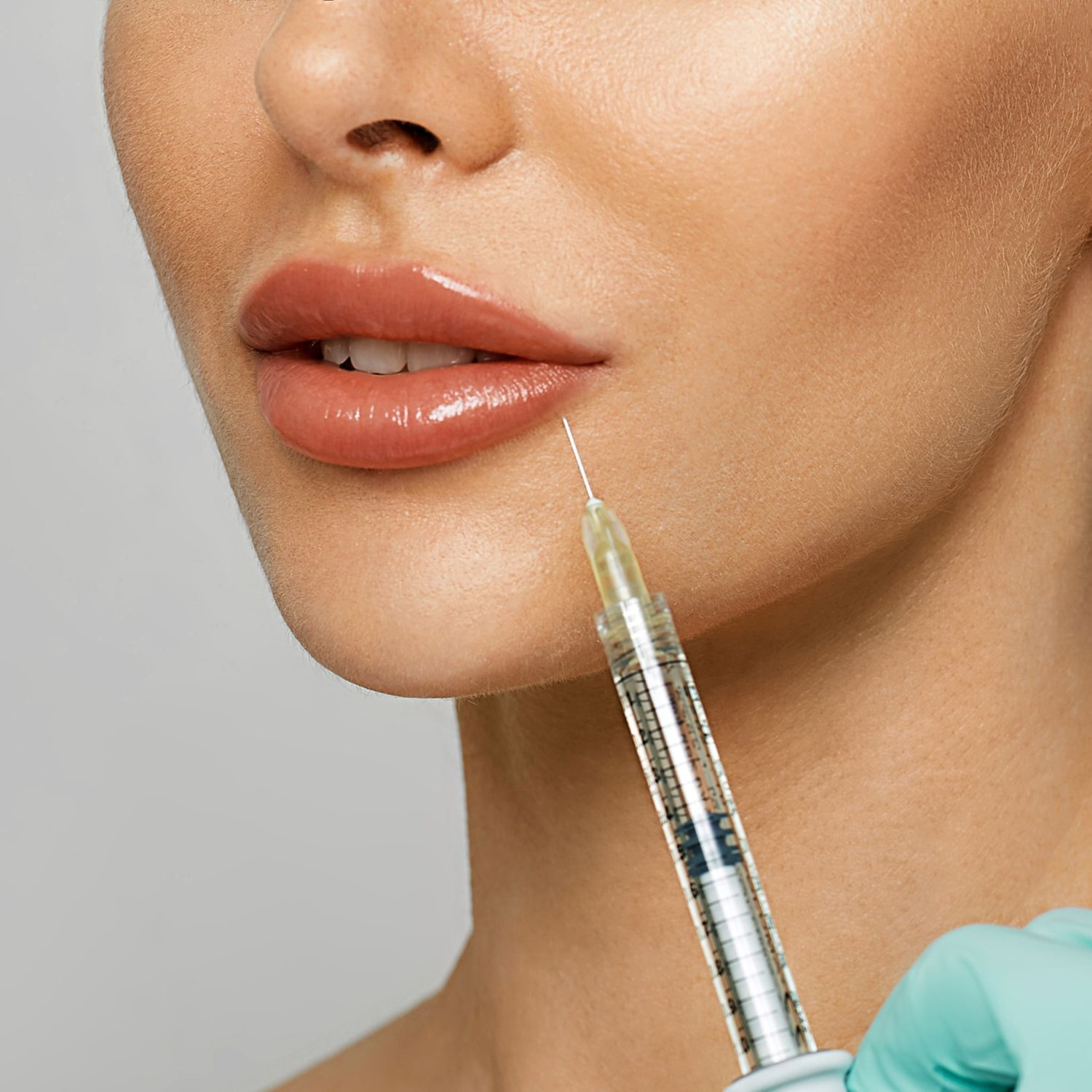 Hylenex (Lip Filler Dissolver) at Elevate Wellness and Weight Management in Wichita Falls, TX