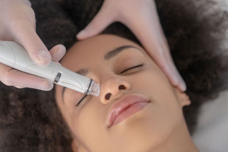 The HydroDerm Facial