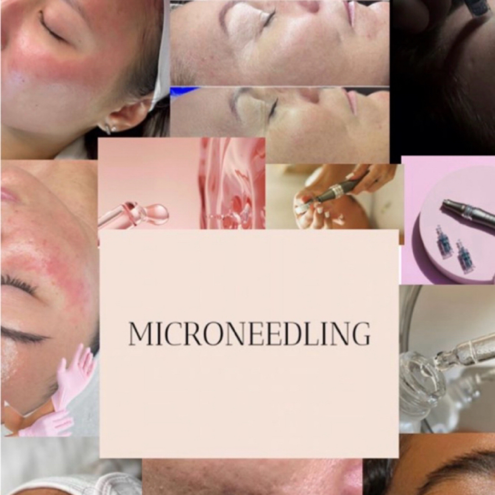 House Call/ Microneedling at 227 Aesthetics in Sterling Heights, MI