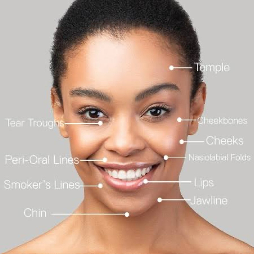 Dermal Fillers at Revive Wellness in El Paso, TX