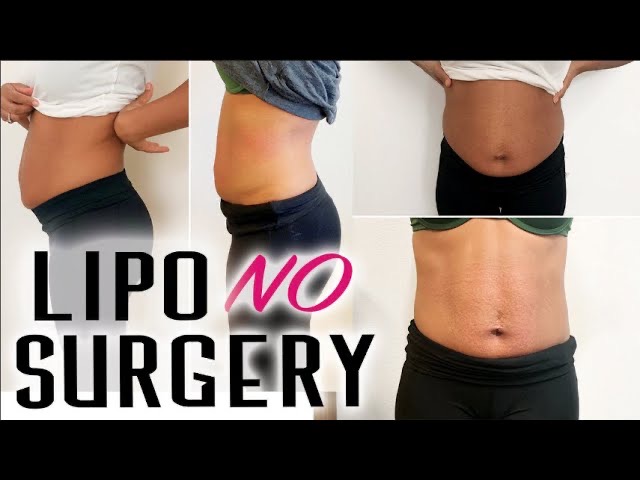 Lipo Cavitation